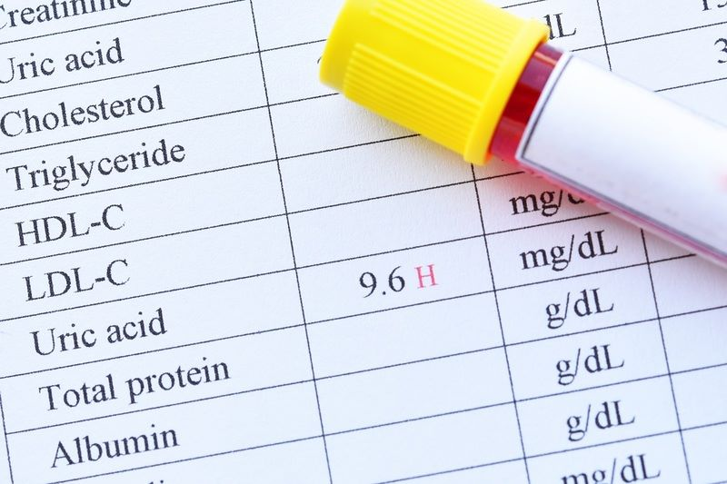 Giải mã 3 chỉ số xét nghiệm máu: Cao hơn có phải luôn tốt hơn?